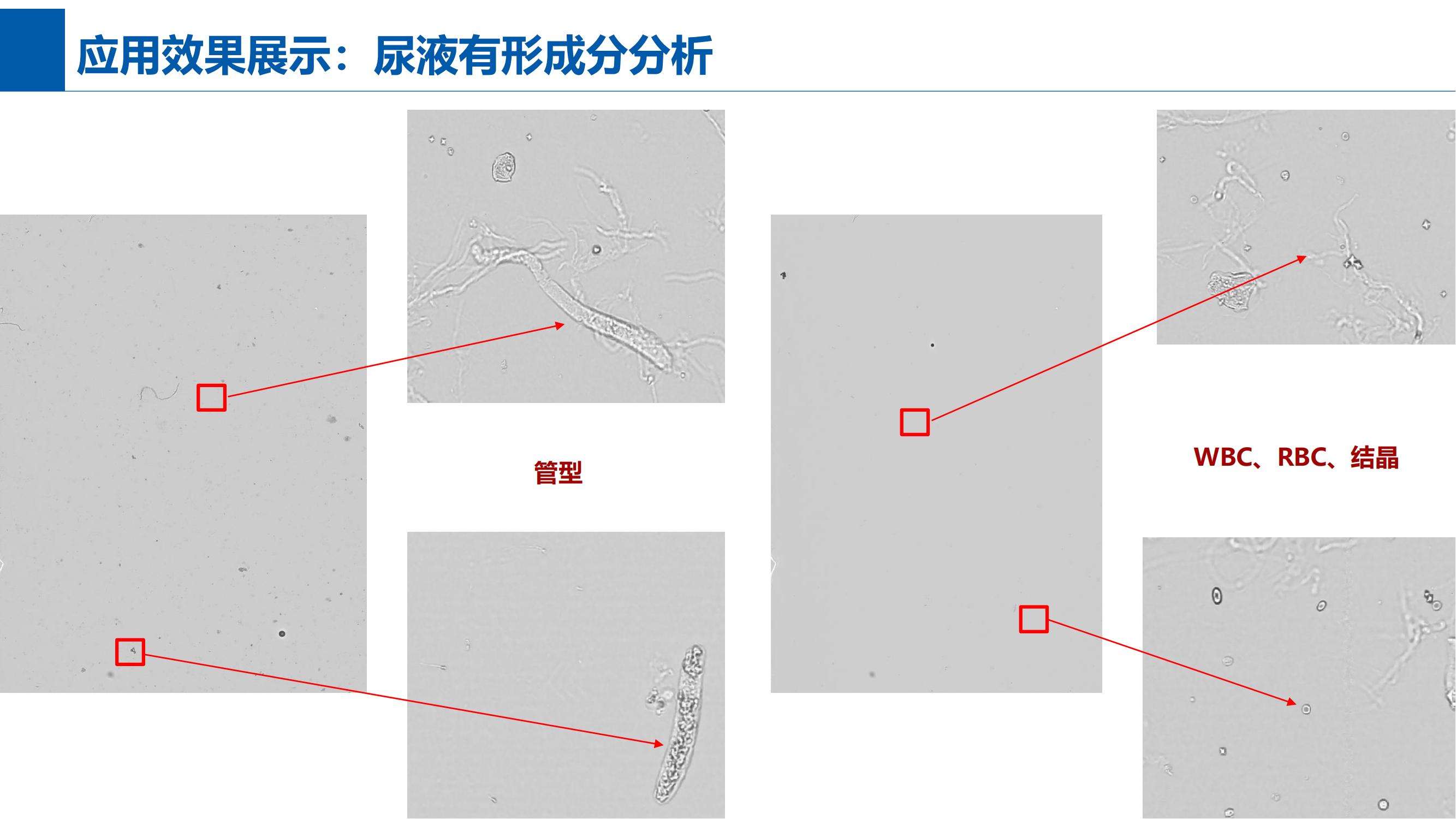 尿液有形成分分析效果一