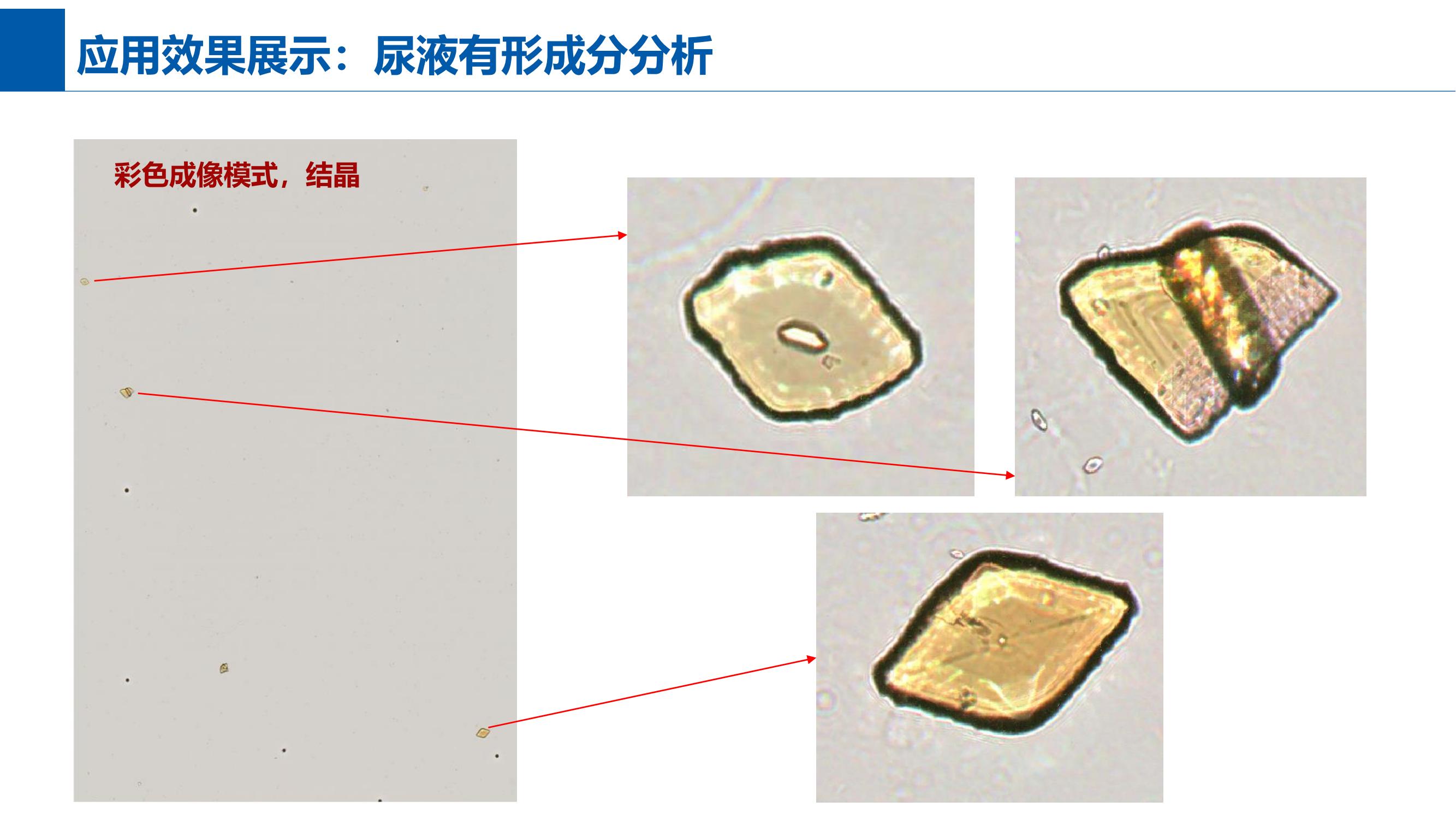 尿液有形成分分析效果二