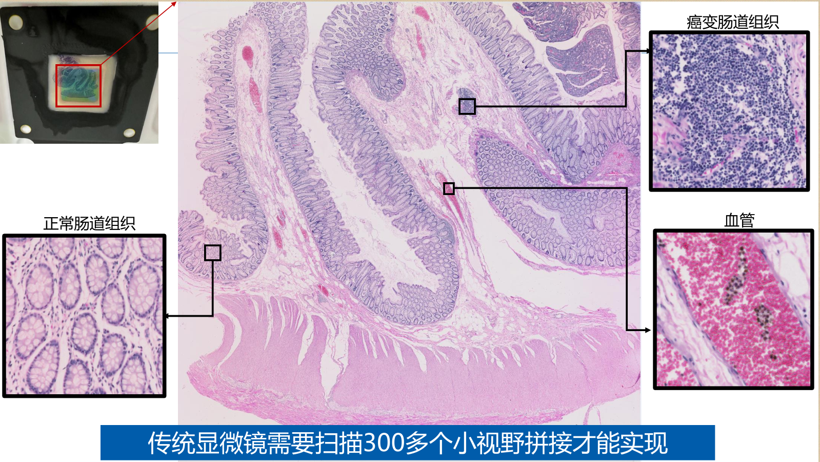 病理全视野成像效果